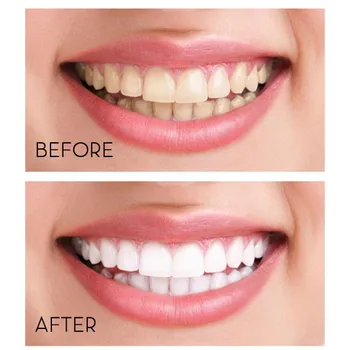 Dinte-De Curățare Spuma De Albire A Dintilor Igienă Orală Indeparteaza Placa Pata Rău Respirația Proaspătă Stralucitoare T1