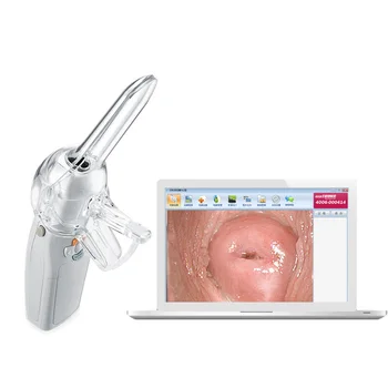 Portabil Digital Video Electronice Mini Colposcop FA2 cu 3000000 Pixeli Camera Endoscop Ginecologie Auto-examen de Detectare A Dr.