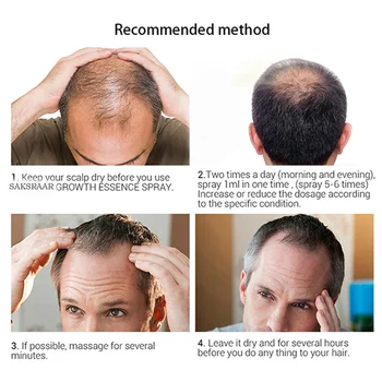 Îngrijirea părului Esența Prevenirea caderii Parului Eficiente de Creștere Hrănește Ulei de Control MH88