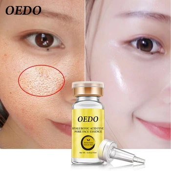 OEDO micsora porii anti-imbatranire anti-liniile fine de acid hialuronic hidratant albire ser facial de plante de îngrijire a pielii de îngrijire facială