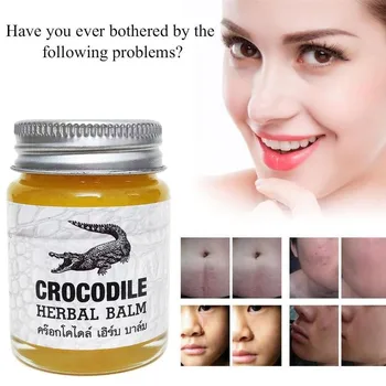 30g Thailanda Crocodil Crema de Ștergere Cicatrice Corpului Față vergeturi, Acnee Cicatrice Remover Pigmentare Corector de Albire Balsam pe bază de Plante