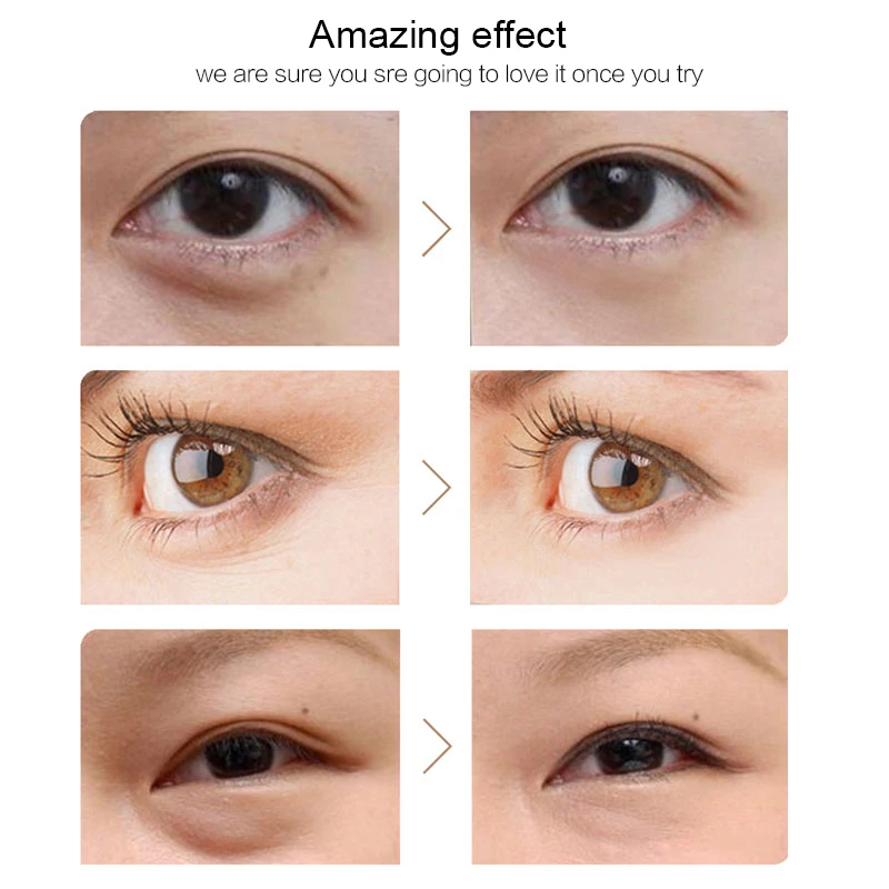 Elizabeth Arden Prevage Anti-Aging Eye Cream | Livrare între zile | qconf.ro