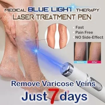 Medical Albastru Terapia cu Lumina Pen Tratament Varice Tratament de Îndepărtare Cicatrice Rid Acnee Moale Cicatrice D0K4