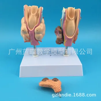 Omului patologie tiroidiană Hipertiroidism anatomice model Tiroide tumora modelul medical