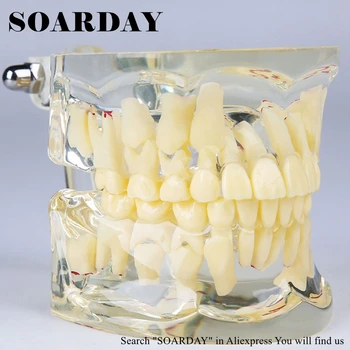 SOARDAY Copii Dintilor Primare Alternativ Transparent Model de Rădăcină Dentară Afișate în mod Clar Dentist Comunicarea cu Pacientul
