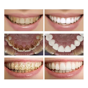 LANBENA Igienă Orală Curățare Ser de Albire a Dintilor Esența Pudra Indeparteaza Placa Petele de Albire a Dintilor Dentare Instrumente de Pasta de dinti