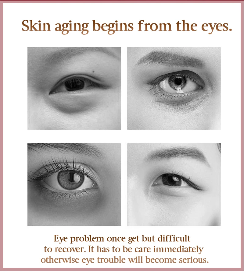 anti crema ochi revizuire riduri