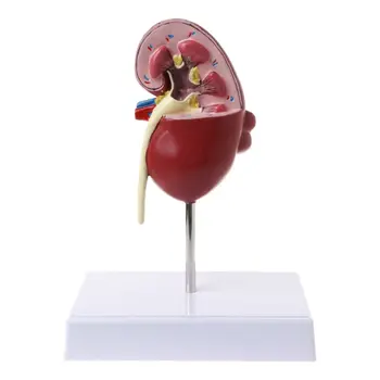 Viața Dimensiunea Umană Rinichi Bolnave Model Anatomice Anatomie Bolnave Patologice Piatra Organ material Didactic 634B