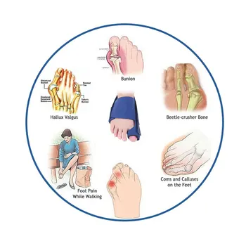 1buc Inflamație la picior Corector Degetul Mare Atelă Orteză de la Picior Întinderea Zi timp de Noapte Tep Separator de Inflamație la picior Ameliorarea Durerii pentru Hallux Valgus