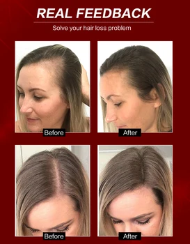 Haircube Cresterea Parului Ulei Esential De Lichid Repararea Produsului Pomadă Prevenirea Caderii Parului Frumusete Dens De Îngrijire A Părului Ser Tratament