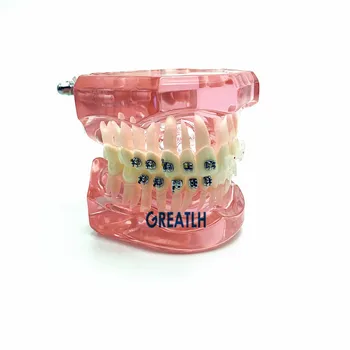Dentare Ortodontice Model cu Metal și Ceramică Paranteze 3003 Roz Dentare elevi Dinți Model de Studiu
